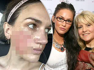 Dr. Nicole Van Groningen, Internal Medicine Physician, Issues Urgent Health Advisory: 3 Surprising Things Top Doctors Avoid