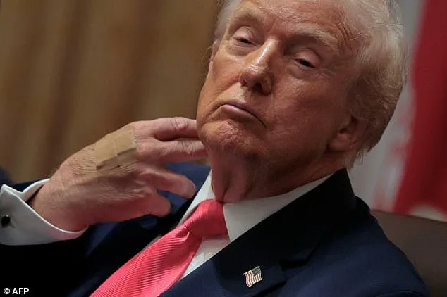 Public Scrutiny and Expert Advisories: Trump's Health Denials Amid Aging Rumors