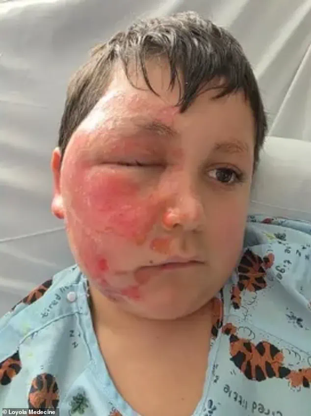Nine-Year-Old Suffers Severe Burns After Microwaving Sensory Toy in Viral TikTok Trend