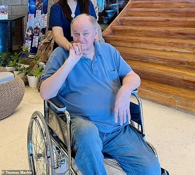 Thomas Markle Sr. Undergoes Prosthetic Leg Fittings Following Life-Saving Amputation