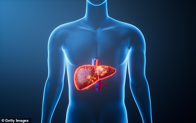 One in ten Americans face deadly liver risks from combined obesity and heavy drinking.