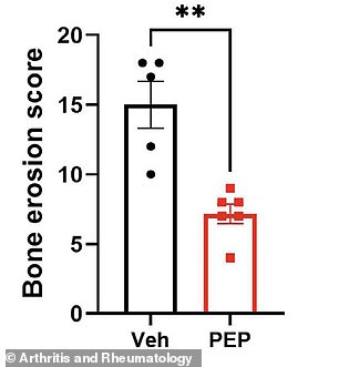 New Peptide Therapy Targets Root Cause of Arthritis Pain