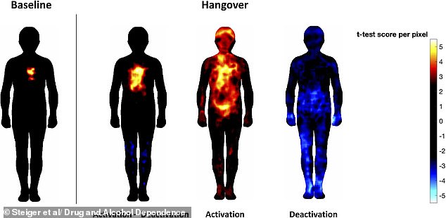 New study maps how alcohol causes pain in the head and weakness in the legs.