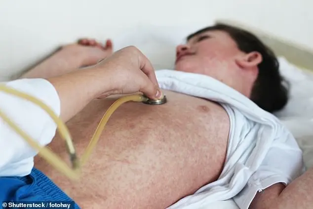 Measles Outbreak in Western Australia After Drake Concert