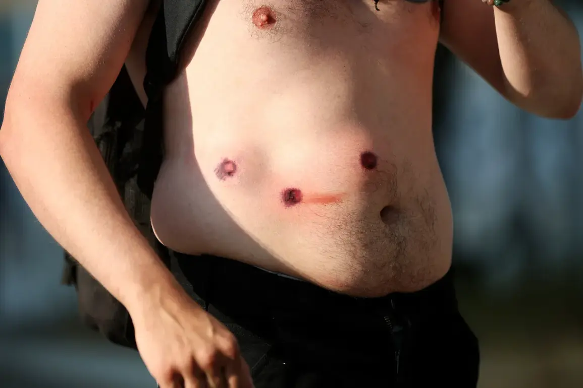 Los Angeles Police Deploy Rubber Bullets and Pepperball Grenades in Escalated Efforts to Quell Protests Beginning June 6