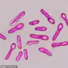 Botulinum Toxin: From One of the World's Most Poisonous Substances to a Popular Cosmetic Treatment