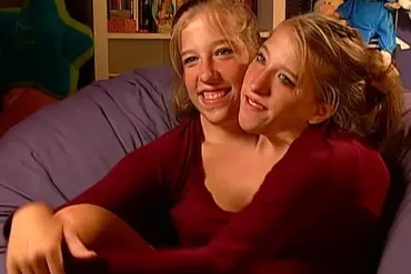 Conjoined Twins Abby and Brittany Hensel Reignite Motherhood Speculation After Spotted with Newborn