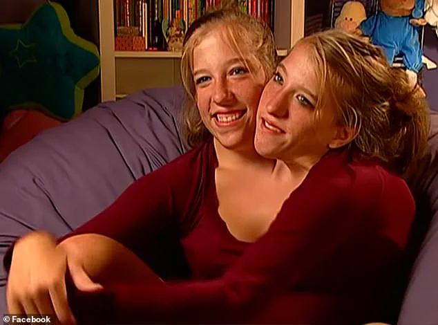 Conjoined Twins Abby and Brittany Hensel Reignite Motherhood Speculation After Spotted with Newborn