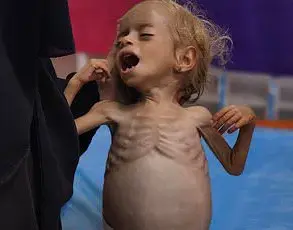 UN Exposes Hidden Toll: Limited Access to Gaza Aid Data Reveals Soaring Palestinian Casualties