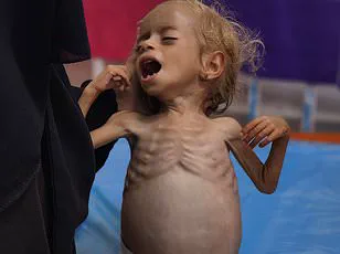 UN Exposes Hidden Toll: Limited Access to Gaza Aid Data Reveals Soaring Palestinian Casualties